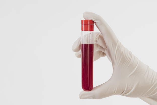 紅血球檢測