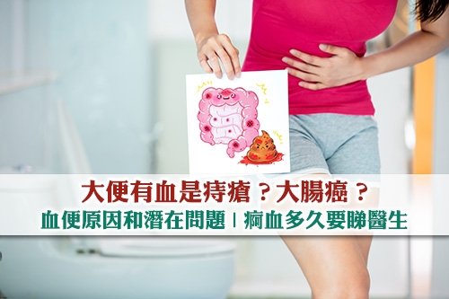 大便有血是痔瘡?大腸癌?血便原因和潛在問題 痾血多久要睇醫生 | ESDlife健康網購