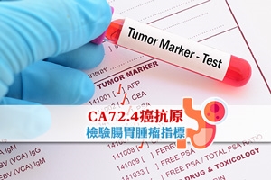 News: 【癌抗原72.4】CA72.4癌抗原 檢驗腸胃腫瘤指標