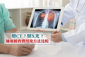 News: 照CT？照X光？肺癌檢查費用及方法比較 | 肺部電腦掃描價錢一覽