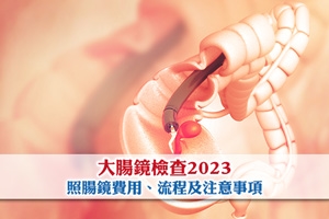 News: 大腸鏡檢查2024|照腸鏡邊間好？大腸鏡檢查費用及流程