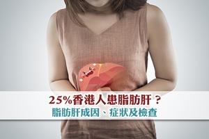 News: 25%香港人患脂肪肝？ 脂肪肝成因、症狀及檢查 慎防變肝硬化硬癌！
