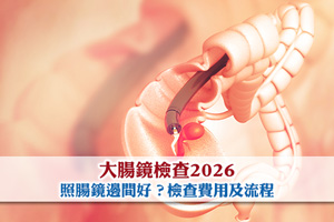 News: 大腸鏡檢查2026|照腸鏡邊間好？大腸鏡檢查費用及流程