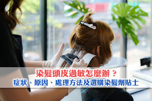 News: 染髮頭皮過敏怎麼辦？症狀、原因及處理方法| 附消委會選購染髮劑貼士
