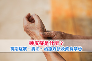 News: 硬皮症是什麼？一文了解初期症狀、壽命影響、治療方法及飲食禁忌
