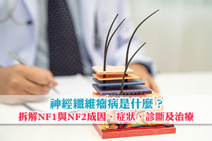 News: 【神經纖維瘤】拆解NF1與NF2成因、症狀、診斷及治療