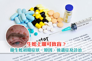 News: 生蛇上眼可致盲？拆解眼生蛇初期症狀、原因、後遺症及治療黃金期