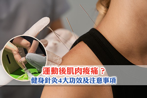 News: 運動後肌肉痠痛？中醫針灸助恢復| 健身針灸4大功效及注意事項
