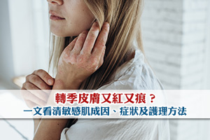 轉季皮膚又紅又痕？一文看清敏感肌成因、症狀及護理方法
