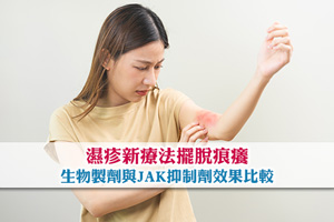 【濕疹新療法】生物製劑與JAK抑制劑效果比較| 擺脫濕疹痕癢