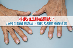 杵狀指是肺癌警號？10秒自我檢測方法、成因及身體檢查建議